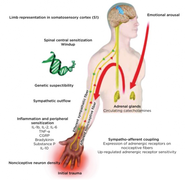 CRPS treatment Archives Dr. Hanna CRPS Pain Doctor Tampa Clearwater